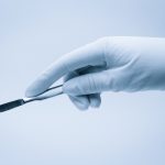 Chirurgie bez umrtvení byla ještě v 19. století realitou. Robert Liston se stal jejím mistrem