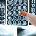 Existuje mužský a ženský mozek? Vliv může mít prenatální testosteron