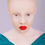 Albíni, rezci i leváci: Těžký život těch, kdo vyčnívají